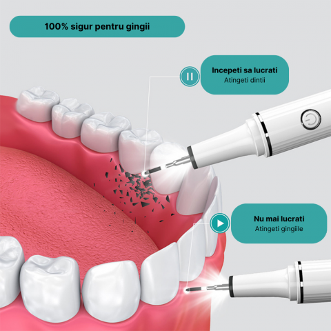 Dispozitiv pentru curatarea dintilor cu ultrasunete MaGeCa®, indeparteaza tartrul si petele, 3 trepte de viteza, rezistent la apa, incarcare USB Type-C, Alb [6]
