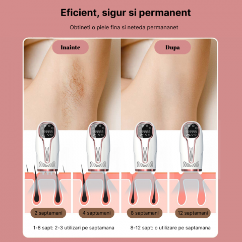 Epilator IPL MaGeCa®, dispozitiv de indepartare a parului cu laser pentru femei si barbati, 5 trepte de intensitate, 999.999 impulsuri pentru fata, brate, picioare, axila si inghinal, Epilare definiti [1]