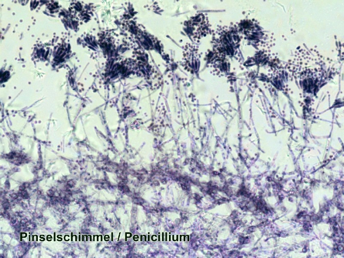 Set preparate microscopice [3]