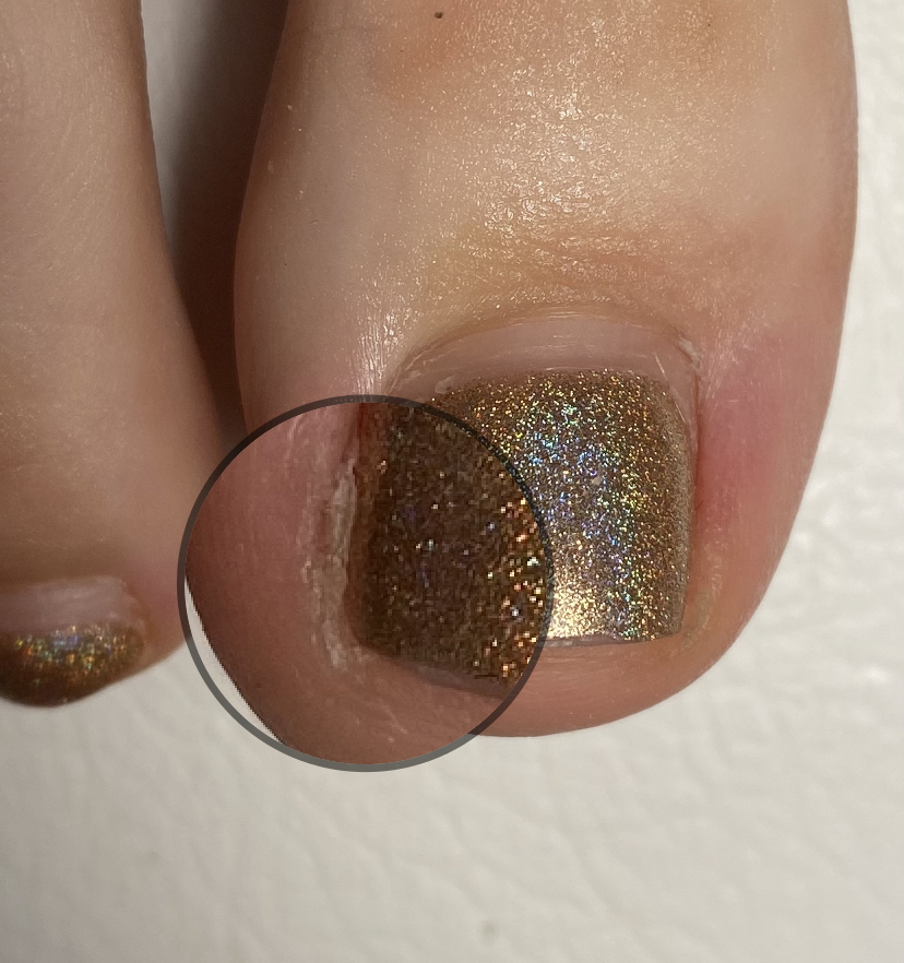 Complex Pedi - 2 zile [2]