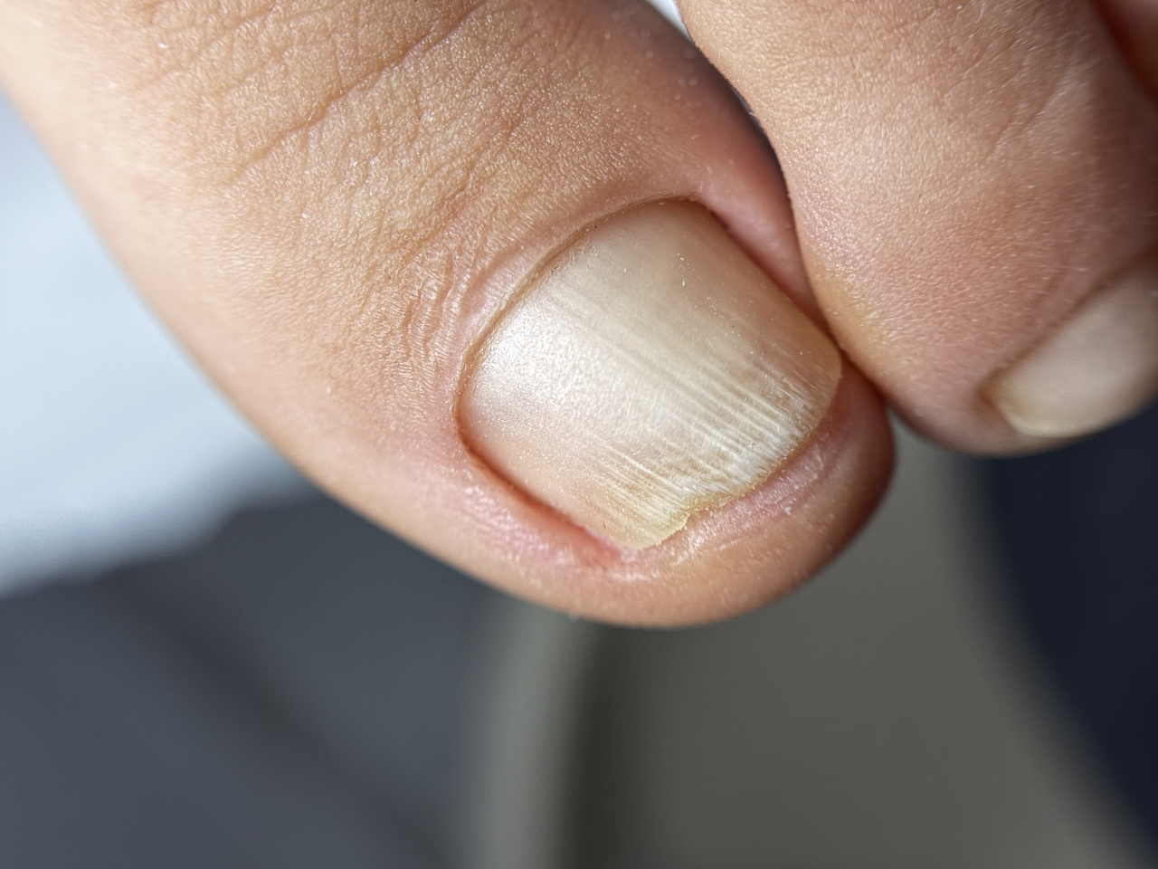 Complex Pedi - 2 zile [2]