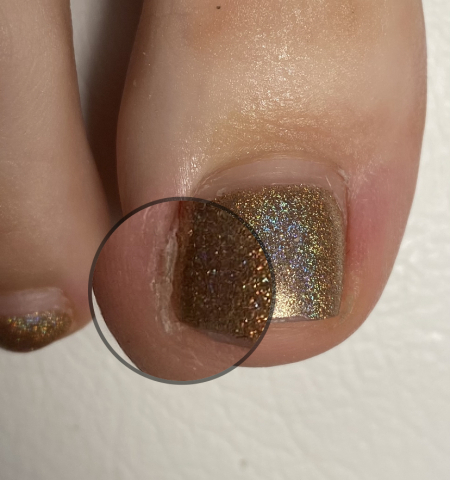 Complex Pedi - 2 zile [1]