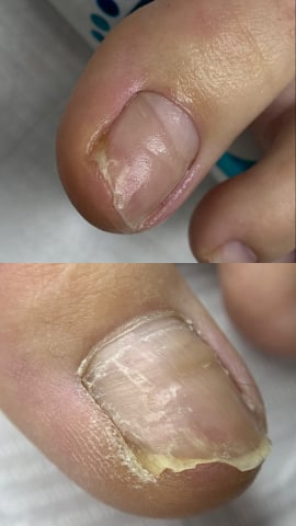 Cursuri Pedichiură - Complex Pedi - 2 zile