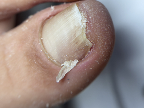 Cursuri Pedichiură - Complex Pedi - 2 zile