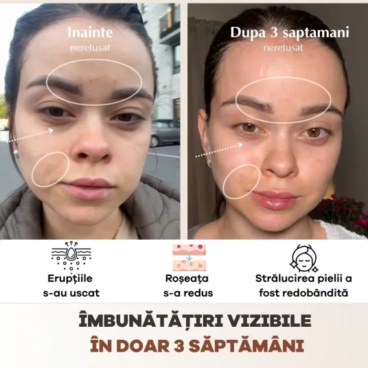 Mască LED Wireless Me Time Ritual – 3 lumini profesionale (roșie + albastră + infraroșie), full-face, silicon medical, 10 min/zi pentru piele ca la 30 de ani [7]