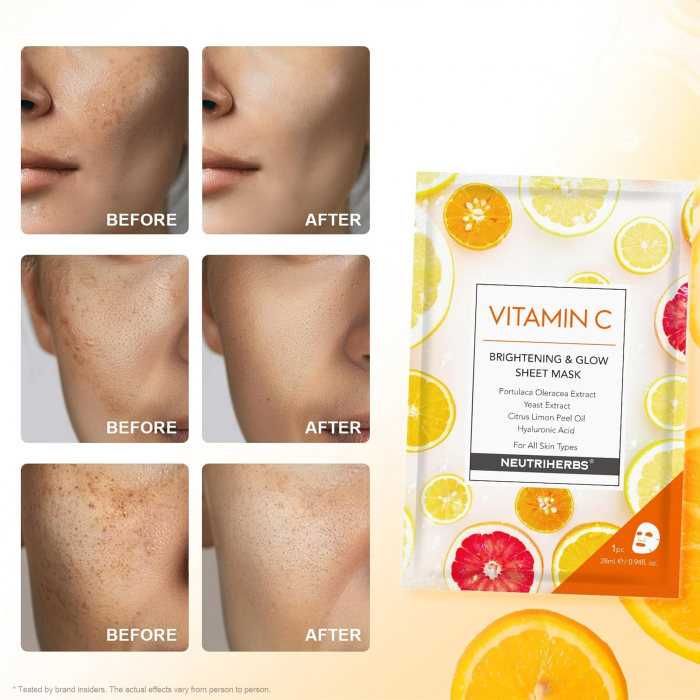 Masca hidratanta de fata cu vitamina C set 5 buc [5]