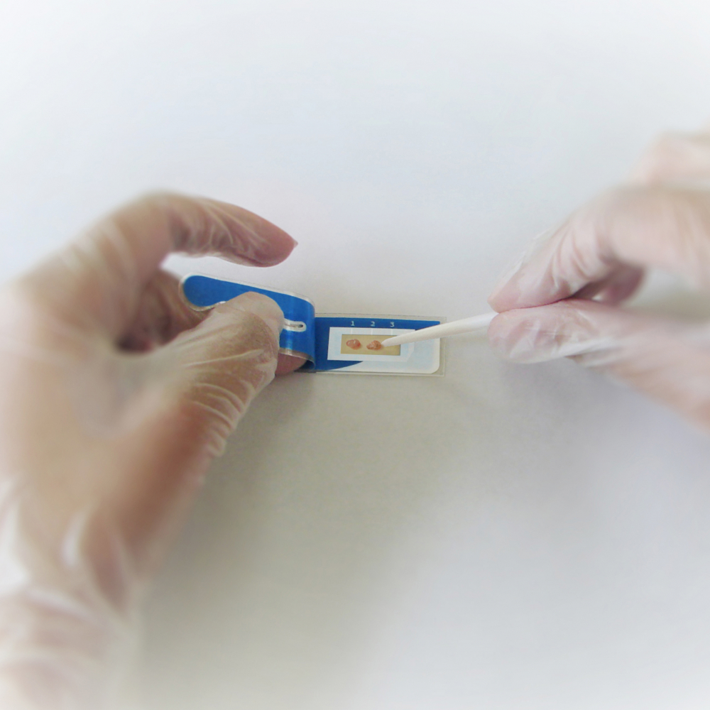 Test rapid la ureaza pentru depistarea Helicobacter pylori AMA RUT EXPERT [2]