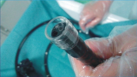 Hemoclipuri endoscopice - Atasamente distale pentru endoscop Olympus