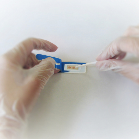 Test rapid la ureaza pentru depistarea Helicobacter pylori AMA RUT EXPERT [1]