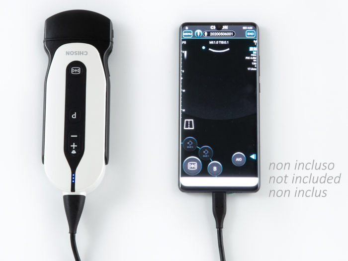 Ecograf portabil SonoEye Palm P5 Convex – Imagini de înaltă calitate, diagnostic rapid [2]