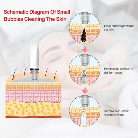 8 az 1-ben HYDRAFACIAL – tökéletes bőrápolás egyetlen készülékben [5]