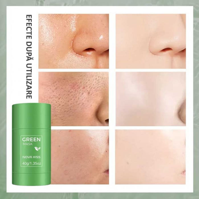 MASCA STICK PREMIUM CU EXTRACT DE CEAI VERDE SI ARGILA, IMPOTRIVA ACNEEI, EXCESULUI DE SEBUM, ANTI PUNCTE NEGRE, NOVA KISS® 40G [5]