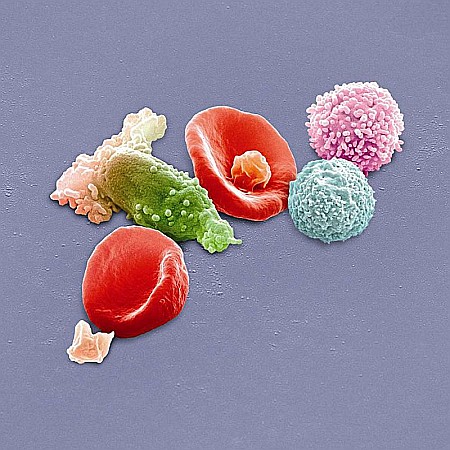 BD Bluray Disc - Peter Gabriel (from Genesis)-New Blood Live In London ( Deluxe Edition)-BD+DVD+2CD