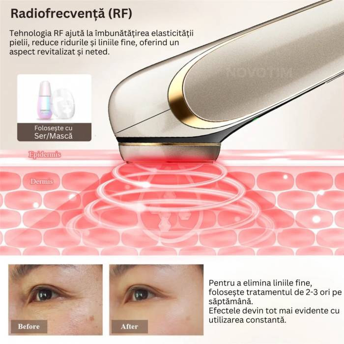 Aparat profesional pentru tratament facial si intinerirea pielii 6 in 1, Lumina rosie & albastra, 4 functii, Mezoterapie, RF, LED, Lifting, Anti Rid, Vibratii EMS, Microcurent, Masaj [5]