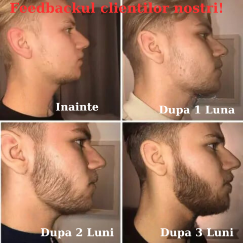 Ulei Barba Premium 30ML pentru Ingrijirea si Stimularea Cresterii Firului de Par si Previne Caderea, Tratament 1 Luna, Ingrediente Extracte Naturale [4]