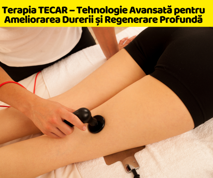 Terapia TECAR – Tehnologie Avansată pentru Ameliorarea Durerii și Regenerare Profundă [2]