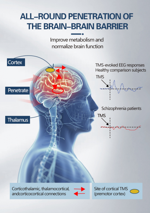 Terapie magnetică transcraniană  profundă RTMS Tratament pentru creier [2]