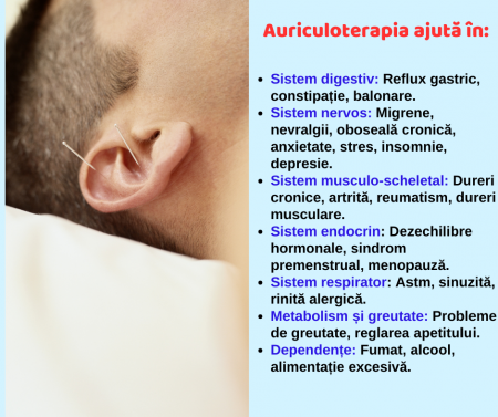 Terapii - Auriculoterapia