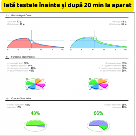 Teslatron – Dispozitiv de Terapie Electrostatică [2]