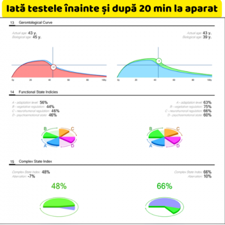 Teslatron – Dispozitiv de Terapie Electrostatică [3]