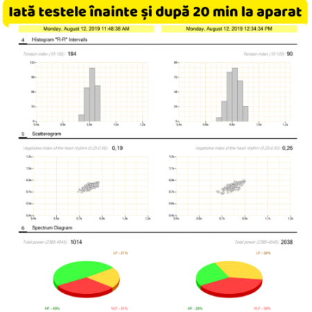 Teslatron – Dispozitiv de Terapie Electrostatică [4]