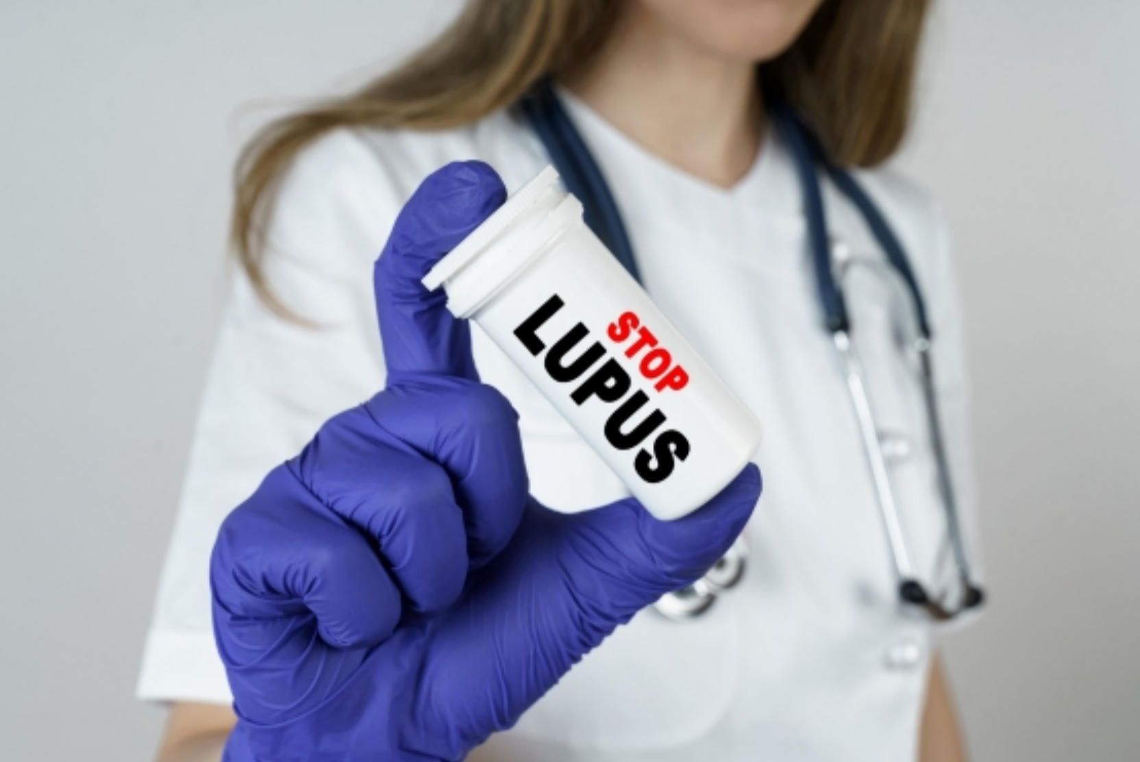 Studiu de caz: Lupus eritematos sistemic 