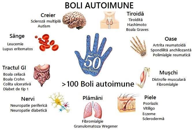 Ovoimuno și bolile autoimune