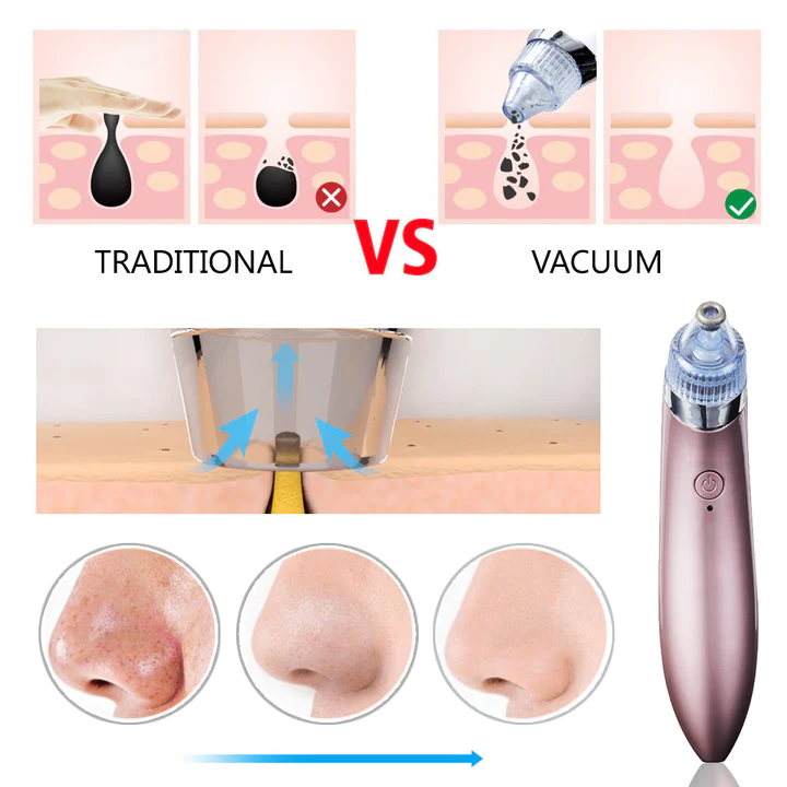 Aparat Vacuum Cleanser aspirator ingrijire ten, curatire cosuri, puncte negre, pori, acnee [1]