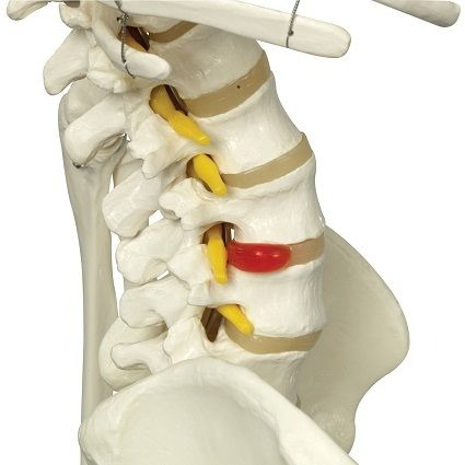 MODEL DE SCHELET FLEXIBIL [3]