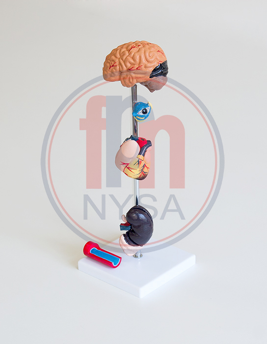 Model hipertensiune arterială, 7 părți [1]