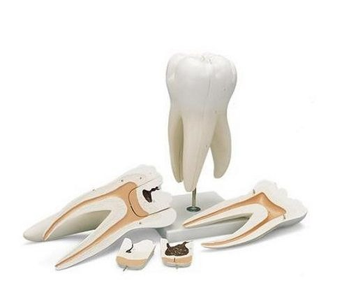 MODEL MOLAR GIGANT CU PREZ CAVITATILOR [1]