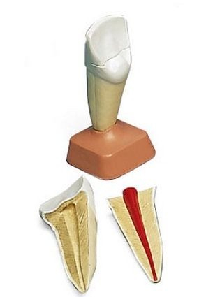 Materiale Didactice Gimnaziu si Liceu - DANTURA INCISIV SUPERIOR 2 PARTI(3B)