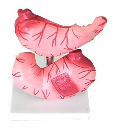 MULAJ STOMAC ( 2 parti) [1]