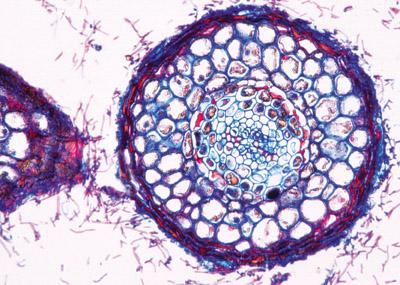 Sectiuni microscopice - VIAȚA PE PĂMÂNT (17 PREPRATE)