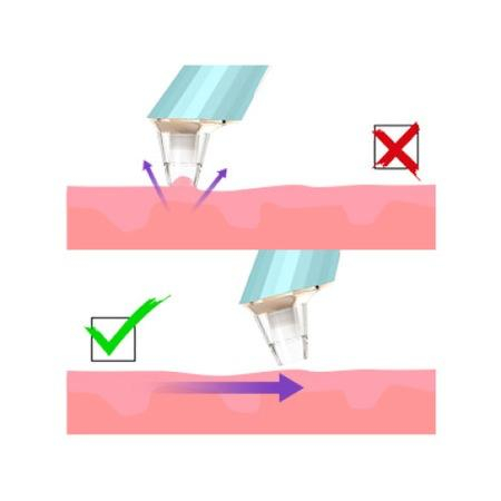 Aspirator vacuum facial pentru curatarea tenului cu 4 capete si incarcare usb [3]