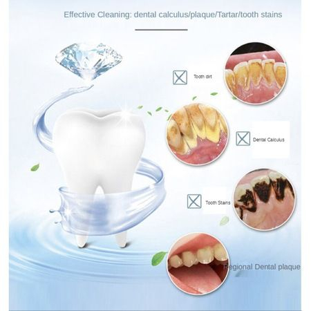 Periuta de dinti sonica 5 in 1, eliminare tartru si albire, cu incarcare usb [4]