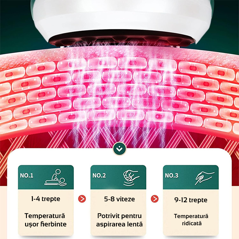 Aparat Masaj Ventuza Anticelulitica [2]