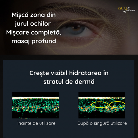 Aparat Masaj Facial QUAL BRAND® cu microcurent EMS, Efect de Lifting, Anticearcane si Antirid, Intinerirea si Intinderea pielii din jurul ochilor, Reincarcabil, Verde [4]