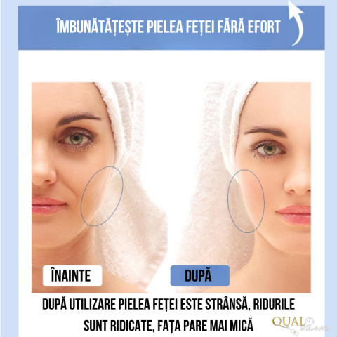 Aparat Masaj Facial [1]