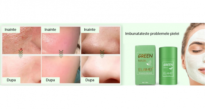 Masca stick Elaimei cu extract de ceai verde si argila alba, impotriva acneei si a punctelor negre, pentru curatare in profunzime si hidratare, 40g [7]