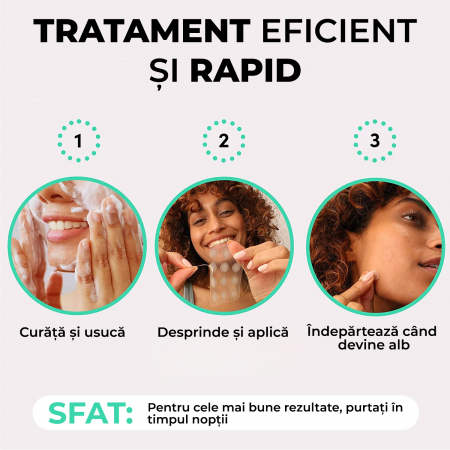 Plasturi translucizi anti acnee [4]