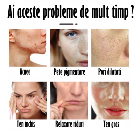 Masca de infrumusetare pentru fata si gat, cu 192 LED-uri si 7 Moduri de Culori, Anti-imbatranire, Anti-sebum, Anti-Acnee, Estompare Riduri fine, Eliminarea petelor si Diminuarea Cearcanelor, Tratamen [7]