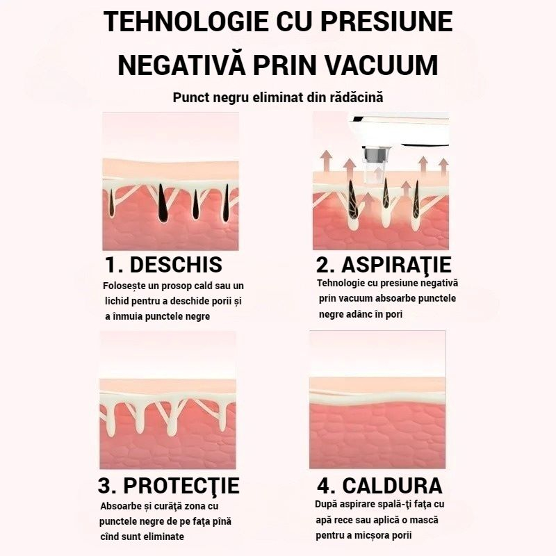 Dispozitiv SERBY pentru Îndepărtarea Punctelor Negre și Curățarea Porilor, 3 Niveluri de Putere, 5 Capete Interșchimbabile, Încărcare USB, Alb [5]