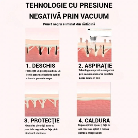 Dispozitiv SERBY pentru Îndepărtarea Punctelor Negre și Curățarea Porilor, 3 Niveluri de Putere, 5 Capete Interșchimbabile, Încărcare USB, Alb [4]