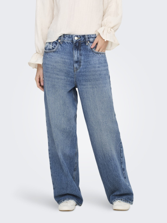 Only Blugi Albastri AMBER Baggy Femei [2]