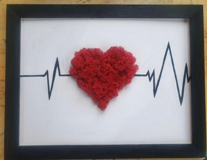 Rama/ Tablou EKG Inima cu licheni [1]