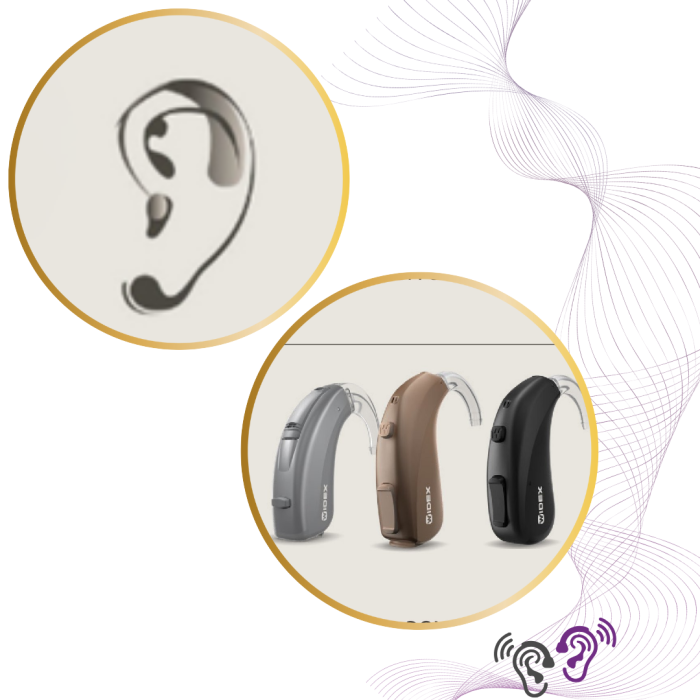 Widex Moment MBB2 440 (BTE) -Sonotech Audiologie [3]