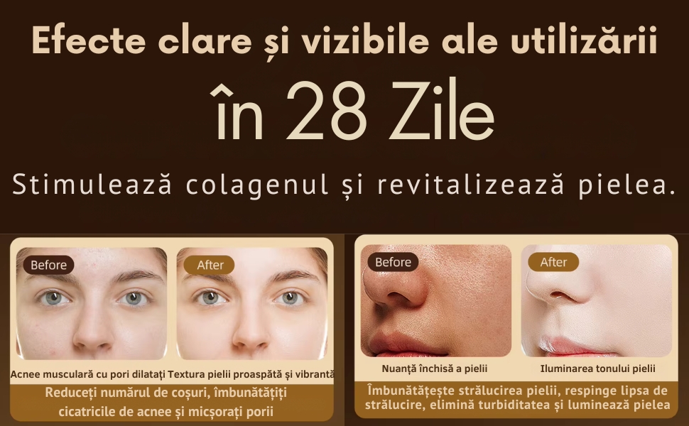 Dispozitiv Terapie cu Lumina Rosie si Infrarosu