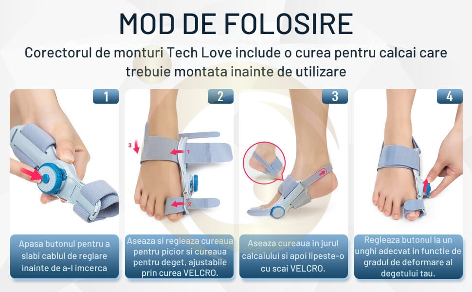 cu ce se trateaza monturile de la picioare