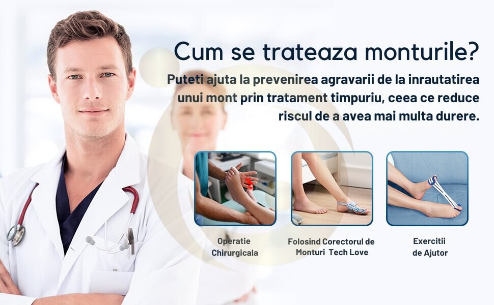 tratament remediu monturi picioare